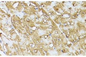 Immunohistochemistry of paraffin-embedded Rat heart using COX15 Polyclonal Antibody at dilution of 1:100 (40x lens). (COX15 Antikörper)
