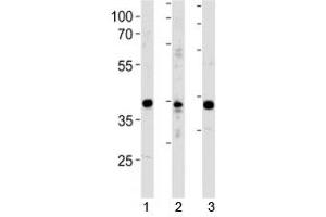 NeuroD1 antibody western blot analysis in 1) Y79 cell line, 2) mouse cerebellum and 3) rat brain tissue lysate. (NEUROD1 Antikörper  (AA 318-348))