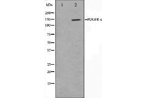 Western blot analysis on 293 cell lysate using PDGFRalpha Antibody,The lane on the left is treated with the antigen-specific peptide.