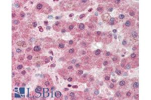 ABIN238663 (5µg/ml) staining of paraffin embedded Human Liver. (PC Antikörper  (Internal Region))