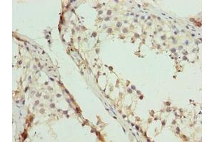 Immunohistochemistry of paraffin-embedded human testis tissue using ABIN7152217 at dilution of 1:100 (EIF5A2 Antikörper  (AA 2-153))