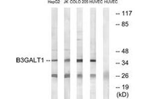 Western blot analysis of extracts from HuvEc/COLO/Jurkat/HepG2 cells, using B3GALT1 Antibody. (B3GALT1 Antikörper  (AA 61-110))
