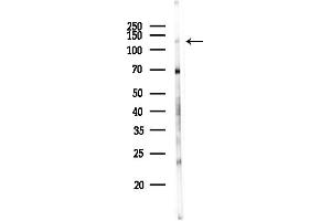 anti-RecQ Protein-Like 4 (RECQL4) (Internal Region) antibody