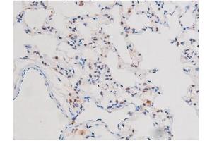 Immunohistochemistry (IHC) image for anti-Signal Transducer and Activator of Transcription 3 (Acute-Phase Response Factor) (STAT3) (pSer727) antibody (ABIN6256411)