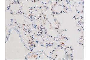 ABIN6267503 at 1/200 staining Rat lung tissue sections by IHC-P. (STAT3 Antikörper  (pSer727))