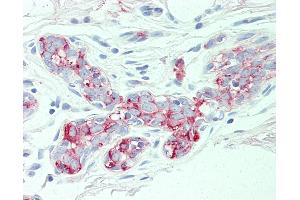 Anti-SLC4A2 antibody IHC of human breast.
