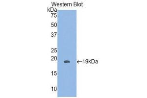 Western Blotting (WB) image for anti-Heat Shock 27kDa Protein 3 (HSPB3) (AA 1-150) antibody (ABIN1859224) (HSPB3 Antikörper  (AA 1-150))