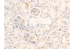ABIN6267234 at 1/100 staining mouse kidney tissue sections by IHC-P. (Survivin Antikörper  (pThr117))
