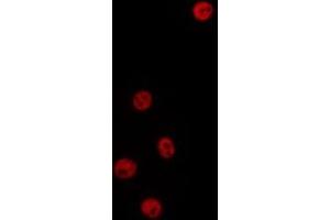 ABIN6277197 staining HepG2 by IF/ICC. (Histone 3 Antikörper  (H3K9me3))