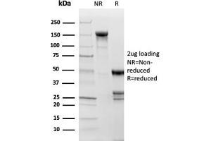 SDS-PAGE Analysis Purified Topoisomerase II alpha, Monoclonal Antibody (TOP2A/1361). (Topoisomerase II alpha Antikörper  (AA 1352-1493))