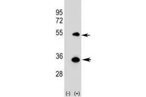 Western blot analysis of ATG5 antibody and 293 cell lysate (2 ug/lane) either nontransfected (Lane 1) or transiently transfected (2) with the human gene. (ATG5 Antikörper  (AA 1-30))