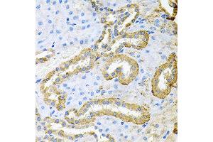 Immunohistochemistry of paraffin-embedded rat kidney using ABL1 antibody at dilution of 1:100 (x40 lens).