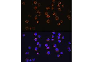 Immunofluorescence analysis of Jurkat cells using CD27 Rabbit mAb (ABIN7266175) at dilution of 1:100 (40x lens). (CD27 Antikörper)
