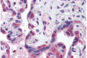 Human Placenta (formalin-fixed, paraffin-embedded) stained with TLR3 antibody ABIN214574 at 5 ug/ml followed by biotinylated goat anti-rabbit IgG secondary antibody ABIN481713, alkaline phosphatase-streptavidin and chromogen. (TLR3 Antikörper  (N-Term))