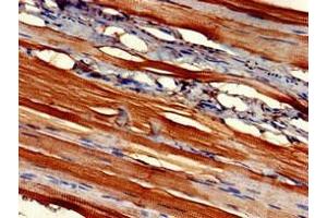 Immunohistochemistry of paraffin-embedded human skeletal muscle tissue using ABIN7152871 at dilution of 1:100 (Fibromodulin Antikörper  (AA 18-89))
