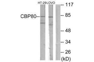 Western blot analysis of extracts from HT-29 cells and LOVO cells, using NCBP1 antibody. (NCBP1 Antikörper  (N-Term))