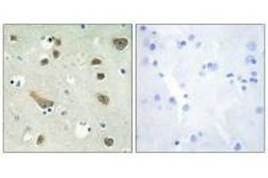Immunohistochemistry analysis of paraffin-embedded human brain tissue using 14-3-3 γ antibody. (14-3-3 gamma Antikörper)