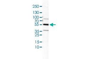 Western Blot (Cell lysate) analysis of U-138 cell lysate.