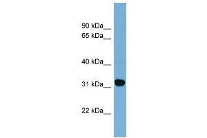 WB Suggested Anti-CBR1  Antibody Titration: 0. (CBR1 Antikörper  (Middle Region))