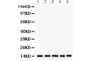 Western Blotting (WB) image for anti-Fatty Acid Binding Protein 1, Liver (FABP1) (AA 6-36), (N-Term) antibody (ABIN3042384)