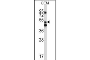 Western Blotting (WB) image for anti-X-Prolyl Aminopeptidase (Aminopeptidase P) 3, Putative (XPNPEP3) (AA 440-469), (C-Term) antibody (ABIN657127)