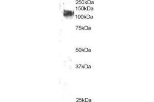 ABIN184673 staining (2µg/ml) of 3T3 lysate (RIPA buffer, 35µg total protein per lane). (CBL Antikörper  (C-Term))