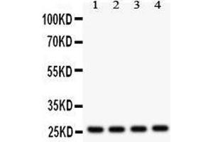 Western Blotting (WB) image for anti-Fms-Related tyrosine Kinase 3 Ligand (FLT3LG) (AA 79-110), (N-Term) antibody (ABIN3042394) (FLT3LG Antikörper  (N-Term))