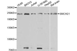 Western blot analysis of extracts of various cell lines, using SMCHD1 antibody (ABIN5974343) at 1/1000 dilution.