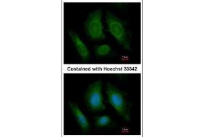 ICC/IF Image Immunofluorescence analysis of paraformaldehyde-fixed HeLa, using OSBPL6, antibody at 1:200 dilution.
