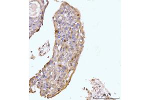 IHC analysis of HMGCS1 using anti-HMGCS1 antibody (ABIN7600928).