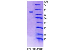 SDS-PAGE (SDS) image for Syntrophin, beta 1 (Dystrophin-Associated Protein A1, 59kDa, Basic Component 1) (SNTB1) (AA 2-297) protein (His tag) (ABIN6238756)