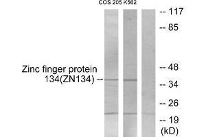 Western blot analysis of extracts from COS-7 cells and K562 cells, using ZNF134 antibody. (ZNF134 Antikörper  (Internal Region))