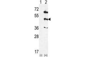 Western Blotting (WB) image for anti-Mitogen-Activated Protein Kinase 12 (MAPK12) antibody (ABIN5023083) (MAPK12 Antikörper)