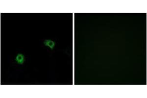 Immunofluorescence analysis of A549 cells, using GPR116 Antibody. (G Protein-Coupled Receptor 116 Antikörper  (AA 1121-1170))