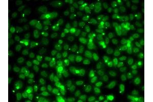 Immunofluorescence analysis of MCF7 cells using RP antibody (ABIN6128654, ABIN6147085, ABIN6147087 and ABIN6218282). (RPA3 Antikörper  (AA 6-121))