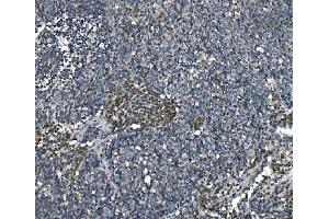 IHC analysis of eRF1/ETF1 using anti-eRF1/ETF1 antibody (ABIN7602626). (ETF1 Antikörper  (AA 9-342))