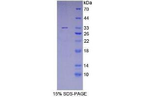 SDS-PAGE (SDS) image for Meningioma Expressed Antigen 5 (Hyaluronidase) (MGEA5) (AA 319-450) protein (His tag) (ABIN1879318)