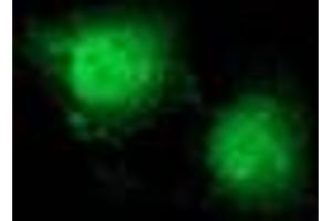 Image no. 9 for anti-Catenin (Cadherin-Associated Protein), beta 1, 88kDa (CTNNB1) antibody (ABIN1496890) (CTNNB1 Antikörper)