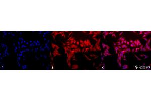 Immunocytochemistry/Immunofluorescence analysis using Rabbit Anti-HO-1 Polyclonal Antibody . (HMOX1 Antikörper  (PE))