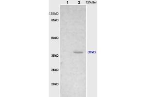 Cathepsin H Antikörper  (AA 71-170)