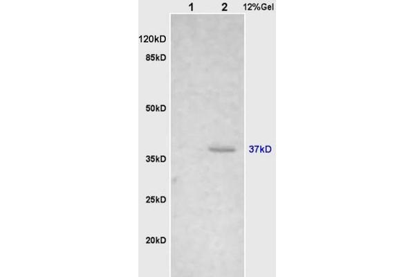 Cathepsin H Antikörper  (AA 71-170)