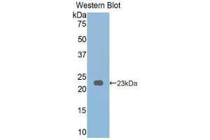 Western blot analysis of the recombinant protein. (PYGL Antikörper  (AA 341-509))