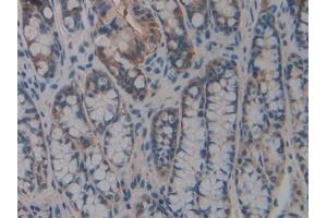 Immunohistochemistry (IHC) image for anti-Dual Adaptor of Phosphotyrosine and 3-phosphoinositides (DAPP1) (AA 1-280) antibody (ABIN7443326)
