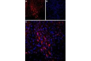 Expression of Parathyroid hormone receptor 1 in rat brain - Immunohistochemical staining of rat dorsal Raphe nucleus using Anti-PTH1R (extracellular) Antibody (ABIN7043429, ABIN7045112 and ABIN7045113). (PTH1R Antikörper  (Extracellular))