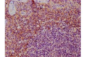 IHC image of ABIN7156884 diluted at 1:600 and staining in paraffin-embedded human tonsil tissue performed on a Leica BondTM system. (IL-3 Antikörper  (AA 20-152))
