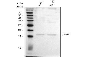 Western blot analysis of GIP using anti-GIP antibody (ABIN4886602).