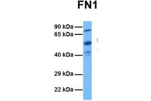 Host:  Rabbit  Target Name:  FN1  Sample Tissue:  Human Ovary Tumor  Antibody Dilution:  1. (Fibronectin 1 Antikörper  (C-Term))
