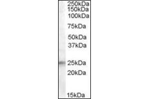 Western Blot: Antibody (0. (IGFBP6 Antikörper  (Internal Region))