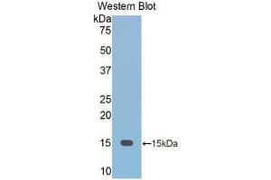 Western blot analysis of the recombinant protein. (FETUB Antikörper  (AA 152-261))