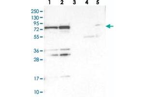 Western blot analysis of Lane 1: RT-4, Lane 2: U-251 MG, Lane 3: Human Plasma, Lane 4: Liver, Lane 5: Tonsil with PTCD1 polyclonal antibody . (PTCD1 Antikörper)